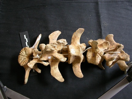 Lumbar vertebrae