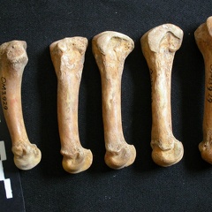 Metacarpals