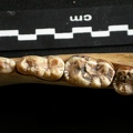 Lower teeth