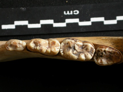 Dentition inférieure