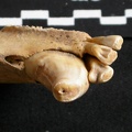 Canine and lower incisors