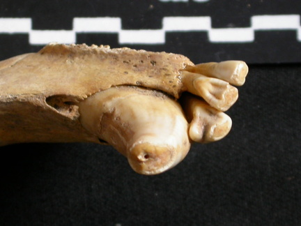Canine and lower incisors