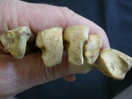 Metatarsianos : parte proximal