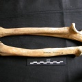 Radius et ulna
