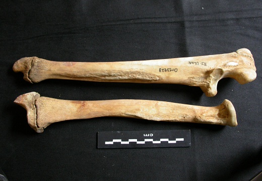 Radius et ulna (10787 visites) Ursus arctos - Femelle - Jeune adulte - Éléments droitsCollection : Département d'Ostéologie du ... Radius et ulna