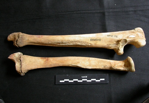 Radius and ulna