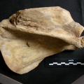 Scapula : vue latérale