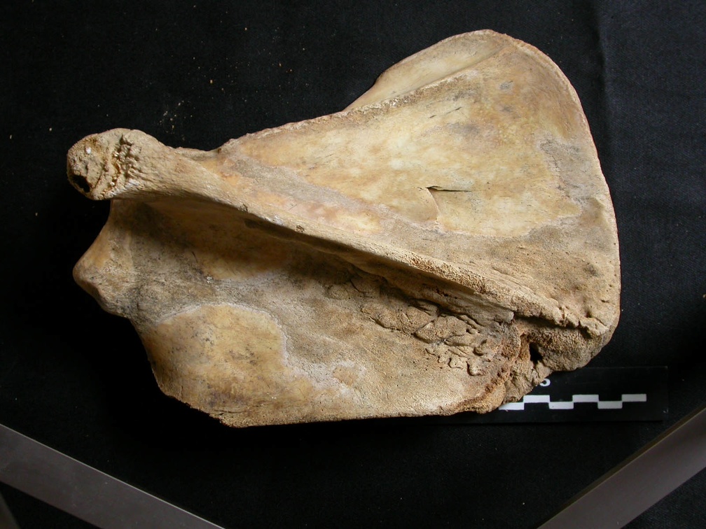 Scapula : vue latérale