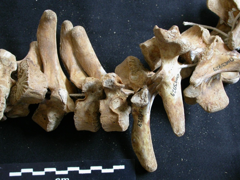 Thoracic vertebrae