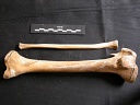 Tibia y fíbula
