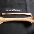 Tibia y fíbula