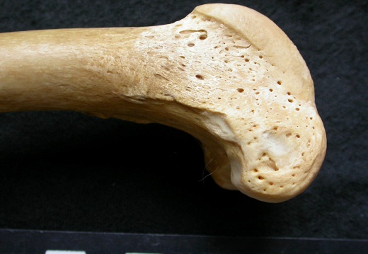 Femur: distal part