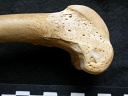 Femur: distal part
