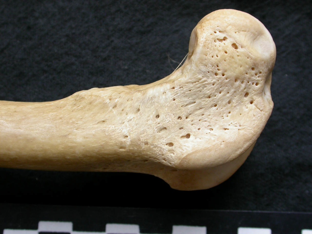 Femur: distal part