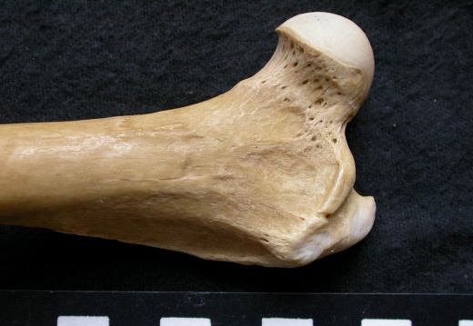 Femur: proximale part