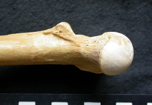 Femur: proximale part