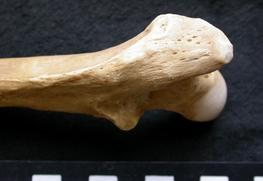 Femur: proximale part