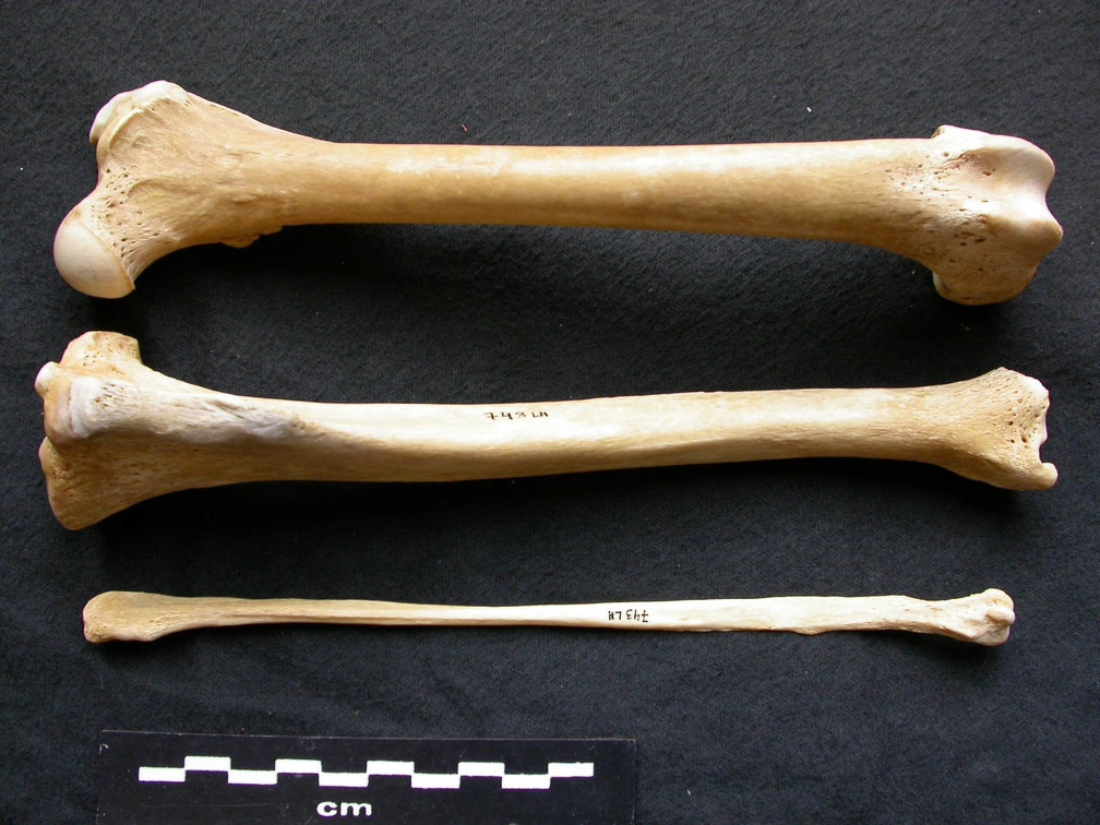  Femur, tibia and fibula