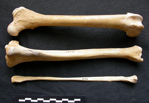  Femur, tibia and fibula