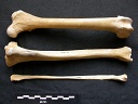 Fémur, tibia et fibula
