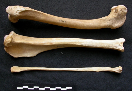  Femur, tibia and fibula