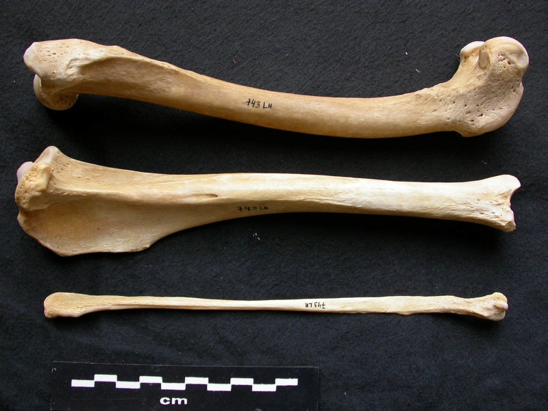 Fémur, tibia et fibula (13101 visites) Canis lupus - Mâle - Adulte - Éléments gauchesCollection : Centre d'Investigation Portugais d'Arc... Fémur, tibia et fibula