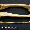  Fémur, tibia y fíbula