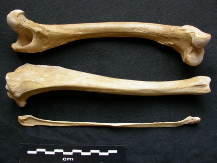  Femur, tibia and fibula