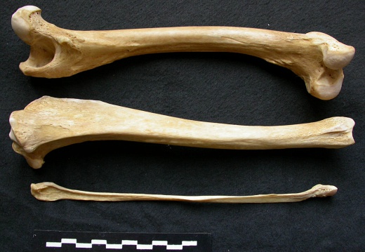  Femur, tibia and fibula