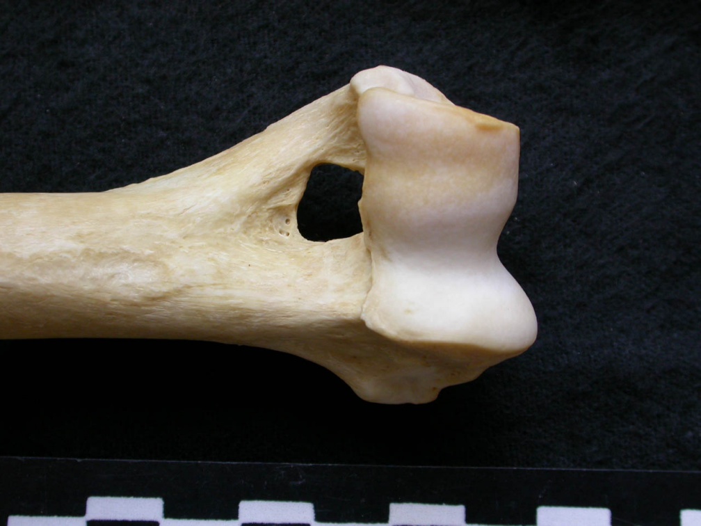 Húmero : parte distal