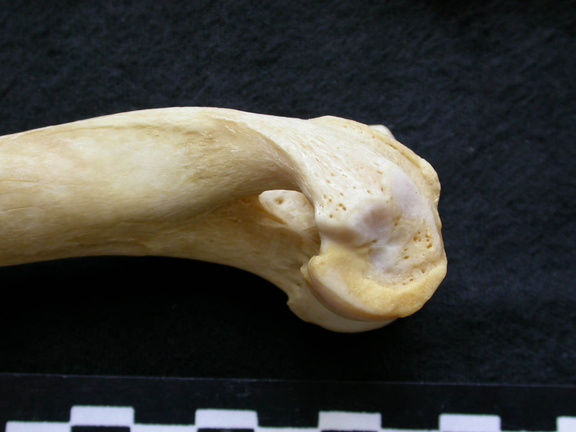 Humerus: distal part