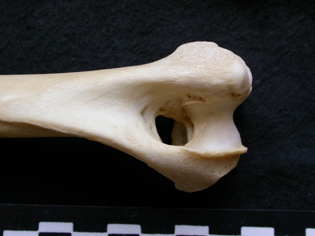 Húmero : parte distal