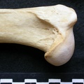 Humerus: proximale part