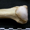 Humerus: proximale part