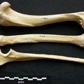 Humérus, radius et ulna