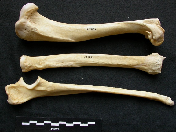 Humerus,radius and ulna