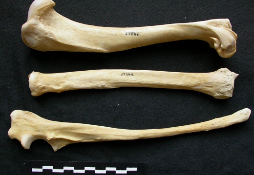 Humerus,radius and ulna