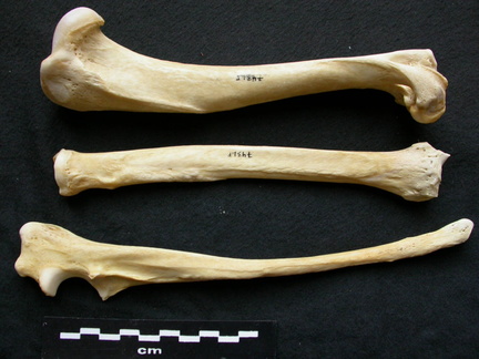 Humérus, radius et ulna