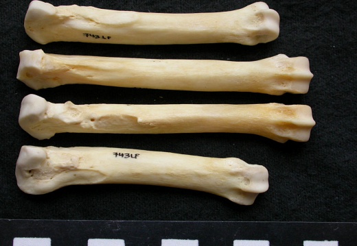 Metacarpals