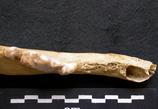 Lower teeth