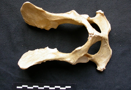 Pelvis