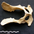 Pelvis