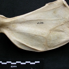 Scapula : vue médiale