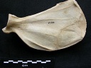 Scapula : vue médiale