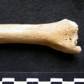 Tibia : partie distale