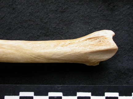 Tibia : partie distale