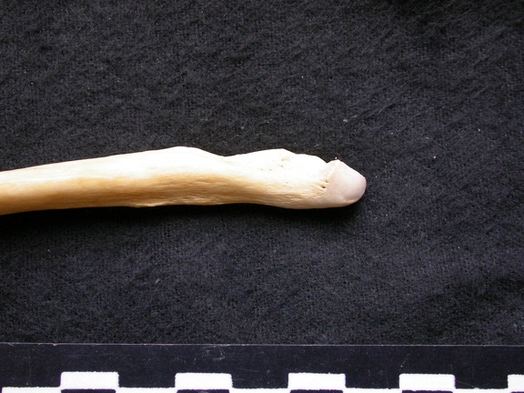 Ulna : partie distale