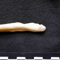 Ulna : partie distale