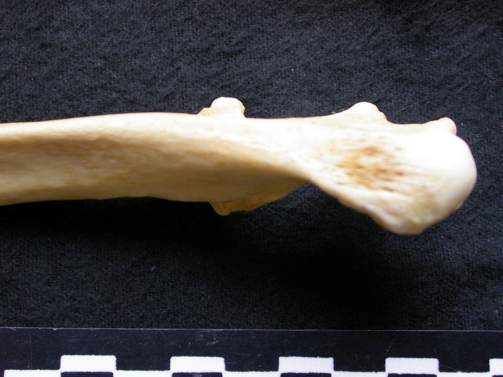 Ulna : partie proximale