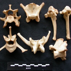 Vertebrae